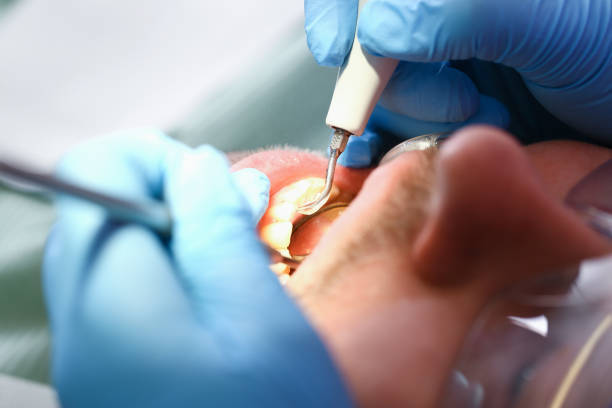 Best Pediatric Emergency Dentist in De Leon Springs, FL