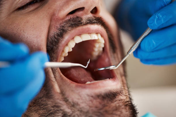 Best Emergency Dentist for Knocked-Out Tooth in De Leon Springs, FL